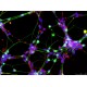 Human Motor Neurons (iPSC-derived, Normal)